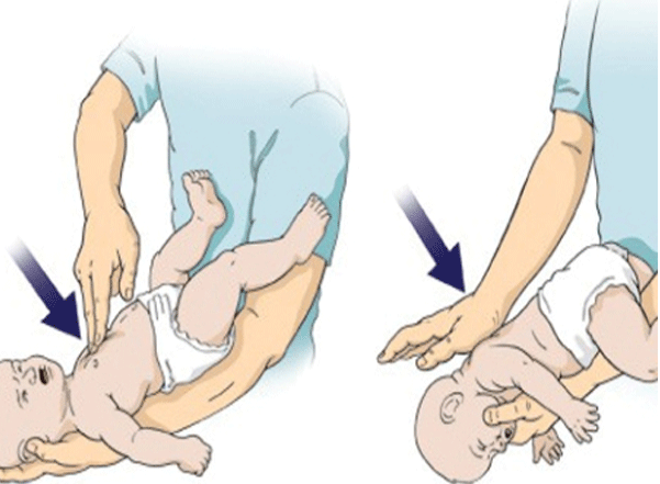 Xử lý trẻ sơ sinh bị sặc sữa nguy hiểm2
